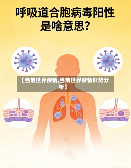 【当前世界疫情,当前世界疫情形势分析】-第1张图片