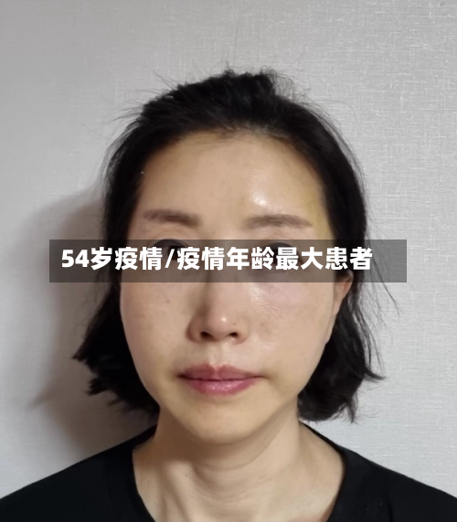 54岁疫情/疫情年龄最大患者-第2张图片