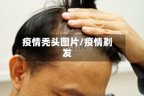 疫情秃头图片/疫情剃发-第1张图片