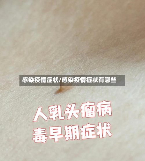 感染疫情症状/感染疫情症状有哪些-第1张图片