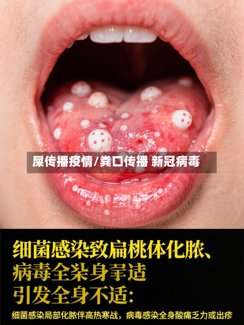 屎传播疫情/粪口传播 新冠病毒-第3张图片